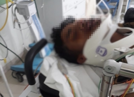 Igor ficou gravemente ferido no acidente