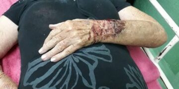 PM diz que idosa machucou ao cair e instaura inquérito policial para apurar denúncias em Santana dos  Montes