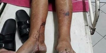 Agressão a idosa provoca revolta e manifestação em Santana dos Montes