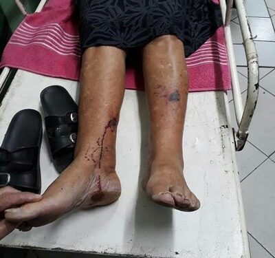 Agressão a idosa provoca revolta e manifestação em Santana dos Montes