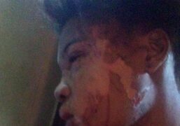 Preso suspeito de agredir, cortar e queimar mulher com óleo fervendo