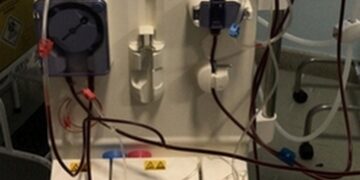 Hospital Bom Jesus adquire aparelho de hemodiálise