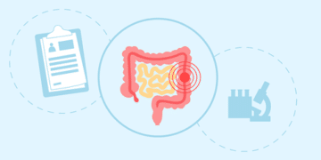 Câncer de intestino: 5 fatos que você precisa saber sobre o câncer de cólon e reto
