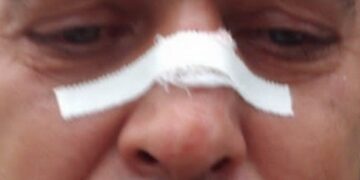 Motorista de aplicativo é assaltado e agredido em Lafaiete