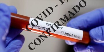 Região tem mais um caso de covid-19 confirmado