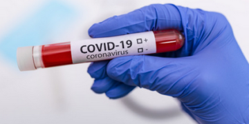 Dados atualizados sobre Covid-19 em Lafaiete