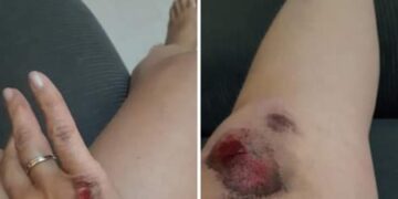 Brasil não existe lei…Lafaiete piorou